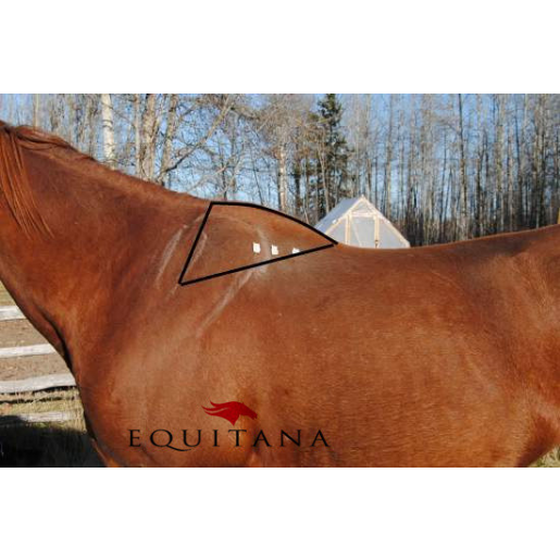 Protectie pentru trapez, Zilco